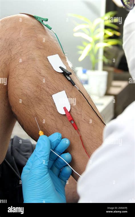 emg-ncv test price philippines|Electromyography .